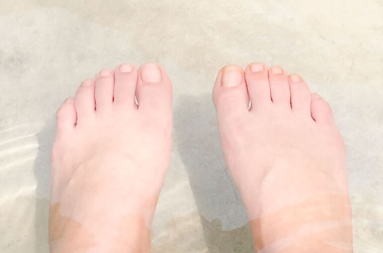 reflexology